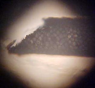 MICROSCOPE PHOTO PHYSICALLY BROKEN HOLLOW PORTION