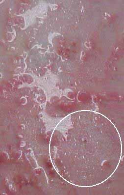 Oil droplets floated up out of musky skin as a result of STOP-ROT treatment.